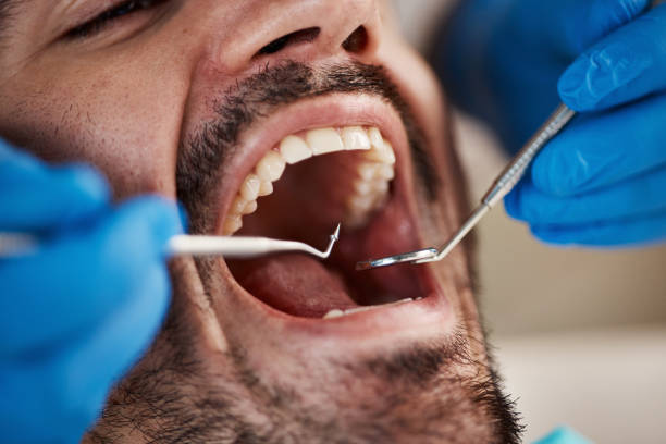 Best Emergency Care for Gum Disease in Belding, MI