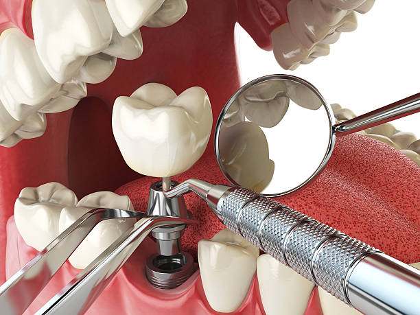 Best Emergency Dental Care for Sports Injuries in Belding, MI
