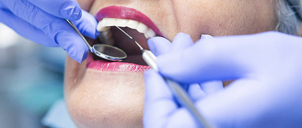 Best Dental Abscess Treatment in Belding, MI